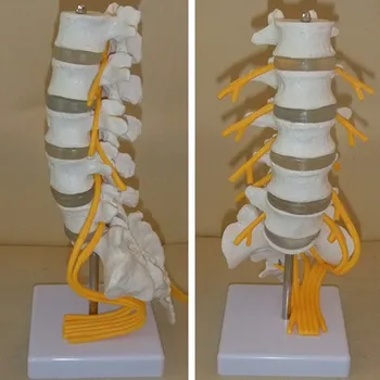 חמש בסעיף המותני מודל השדרה עם האחוריים זנב הסוס עצב בעמוד השדרה המותני דיסק דגם השדרה כירופרקטיקה שלד מודל